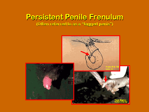 Frenulum penis